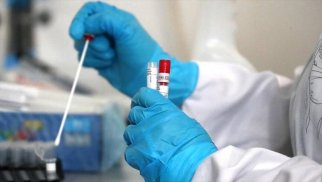 Mərkəzi Bankının əməkdaşları koronavirus testi verəcək