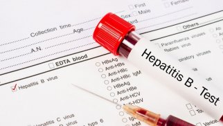 Ötən il Azərbaycanda hepatit xəstəliyindən neçə nəfər ölüb? - RƏSMİ