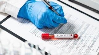Azərbaycanda daha 53 nəfər koronavirusa yoluxdu, 7 nəfər öldü