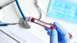 Azərbaycanda daha 36 nəfər koronavirusa yoluxub, 2 nəfər ölüb