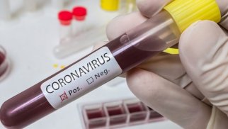 Daha 15 nəfər koronavirusa yoluxub, ölən olmayıb