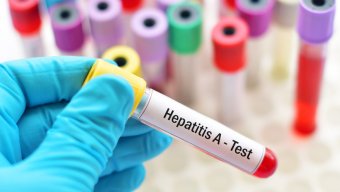 TƏBİB: Bir sıra regionlarda hepatit A virusuna yoluxma müşahidə edilir