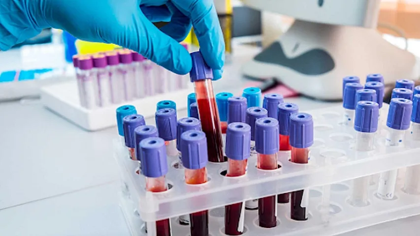 Azərbaycana insan və heyvan qanı satan ölkələr 