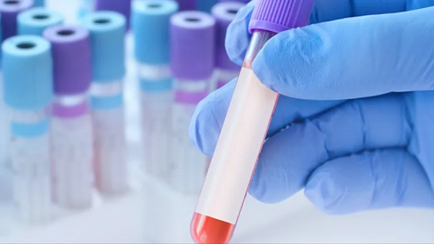 Bu xəstəliklərin diaqnostikası da icbari tibbi sığortaya daxildir