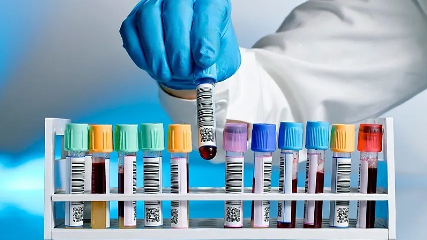 11 tibb mərkəzi üçün 21 milyonluq laboratoriya testləri alınacaq