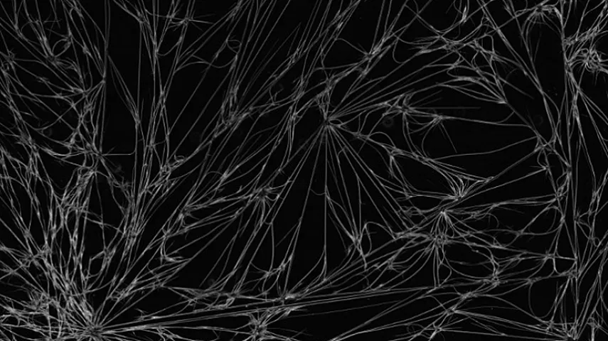 &ldquo;Dark pattern&rdquo;lə saytlar istifadəçiləri necə aldadır?